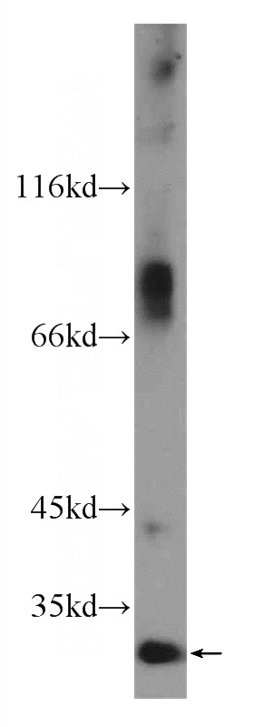 HeLa cells were subjected to SDS PAGE followed by western blot with Catalog No:108609(C16orf72 Antibody) at dilution of 1:300