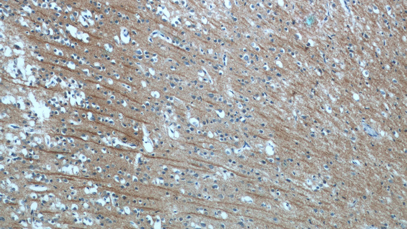 Immunohistochemistry of paraffin-embedded human brain tissue slide using Catalog No:113207(NPB Antibody) at dilution of 1:50 (under 10x lens)