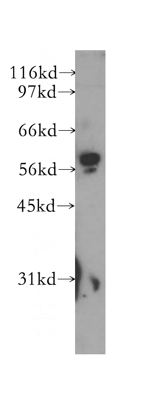 human liver tissue were subjected to SDS PAGE followed by western blot with Catalog No:112470(MAOB antibody) at dilution of 1:300