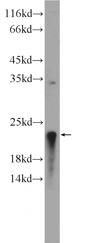 HepG2 cells were subjected to SDS PAGE followed by western blot with Catalog No:110315(EEF1E1 Antibody) at dilution of 1:1000