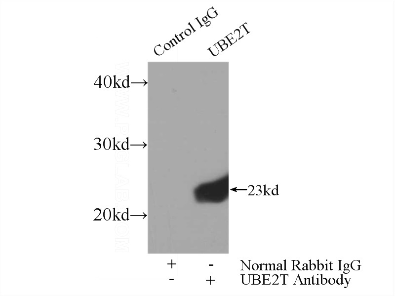 IP Result of anti-UBE2T (IP:Catalog No:116537, 3ug; Detection:Catalog No:116537 1:500) with HeLa cells lysate 3000ug.