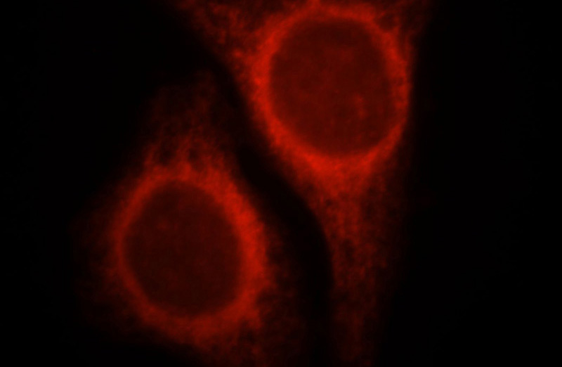 Immunofluorescent analysis of HepG2 cells, using NR3C2 antibody Catalog No:113268 at 1:25 dilution and Rhodamine-labeled goat anti-rabbit IgG (red).