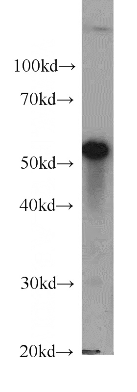MCF7 cells were subjected to SDS PAGE followed by western blot with Catalog No:107408(LPCAT1 antibody) at dilution of 1:500