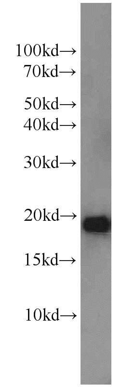 HepG2 cells were subjected to SDS PAGE followed by western blot with Catalog No:113071(NDUFB11 antibody) at dilution of 1:800