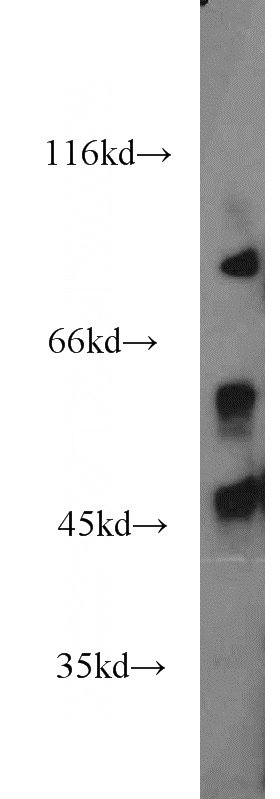 L02 cells were subjected to SDS PAGE followed by western blot with Catalog No:110295(ECM2 antibody) at dilution of 1:200