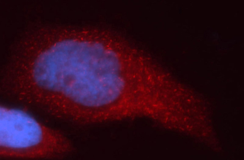 Immunofluorescent analysis of Hela cells, using RRM1 antibody Catalog No:114923 at 1:50 dilution and Rhodamine-labeled goat anti-rabbit IgG (red). Blue pseudocolor = DAPI (fluorescent DNA dye).