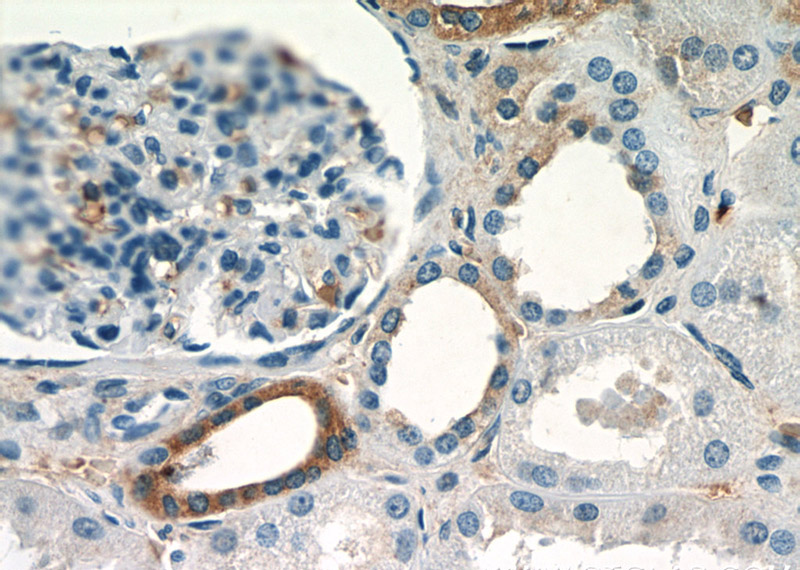 Immunohistochemistry of paraffin-embedded human kidney slide using Catalog No:115170(SLC5A4 Antibody) at dilution of 1:50