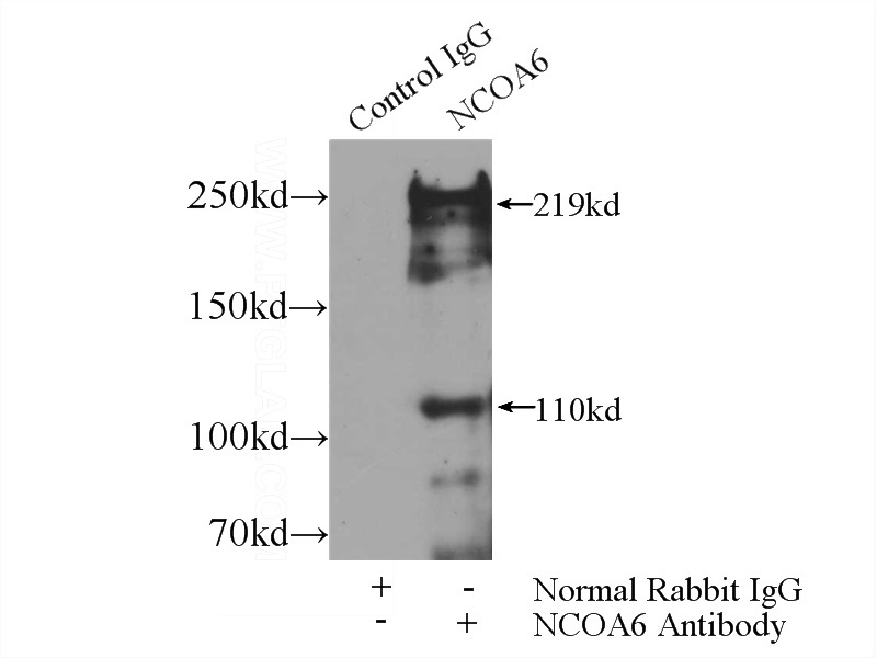 IP Result of anti-NCOA6 (IP:Catalog No:113044, 4ug; Detection:Catalog No:113044 1:1000) with HEK-293 cells lysate 2560ug.