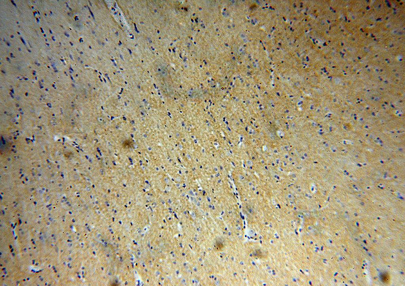 Immunohistochemical of paraffin-embedded human brain using Catalog No:112466(MANBAL antibody) at dilution of 1:100 (under 10x lens)