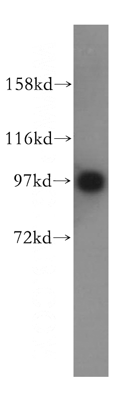 human brain tissue were subjected to SDS PAGE followed by western blot with Catalog No:111819(IPO13 antibody) at dilution of 1:500