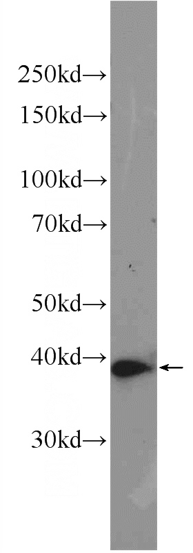 K-562 cells were subjected to SDS PAGE followed by western blot with Catalog No:108010(PRKAG1 Antibody) at dilution of 1:1000