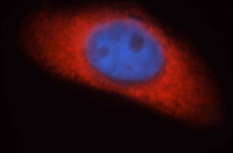 Immunofluorescent analysis of MCF-7 cells, using EIF2AK2 antibody Catalog No:110180 at 1:25 dilution and Rhodamine-labeled goat anti-rabbit IgG (red).Blue pseudocolor = DAPI (fluorescent DNA dye).