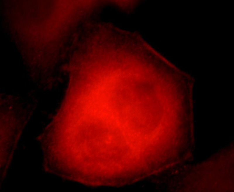Immunofluorescent analysis of HepG2 cells, using C17orf28 antibody Catalog No:108612 at 1:25 dilution and Rhodamine-labeled goat anti-rabbit IgG (red).