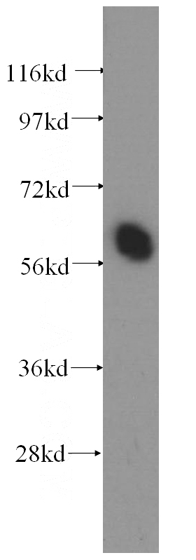 Y79 cells were subjected to SDS PAGE followed by western blot with Catalog No:109516(CPNE3 antibody) at dilution of 1:400