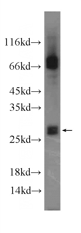 mouse spleen tissue were subjected to SDS PAGE followed by western blot with Catalog No:112919(MYCT1 antibody) at dilution of 1:1000