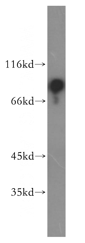 HeLa cells were subjected to SDS PAGE followed by western blot with Catalog No:114546(RAP1GAP antibody) at dilution of 1:800