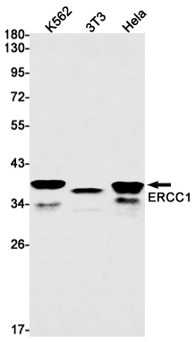 Western blot detection of ERCC1 in K562,3T3,Hela cell lysates using ERCC1 Rabbit mAb(1:1000 diluted).Predicted band size:33kDa.Observed band size:39kDa.