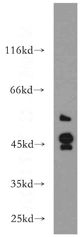 MCF7 cells were subjected to SDS PAGE followed by western blot with Catalog No:114969(S1PR2 antibody) at dilution of 1:100
