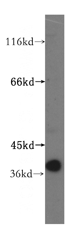 mouse skin tissue were subjected to SDS PAGE followed by western blot with Catalog No:111103(GMPR antibody) at dilution of 1:500