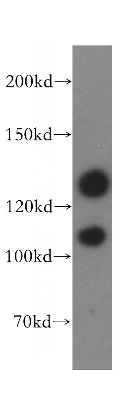 mouse testis tissue were subjected to SDS PAGE followed by western blot with Catalog No:112156(LATS1 antibody) at dilution of 1:500