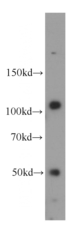 mouse kidney tissue were subjected to SDS PAGE followed by western blot with Catalog No:108869(CASK antibody) at dilution of 1:300