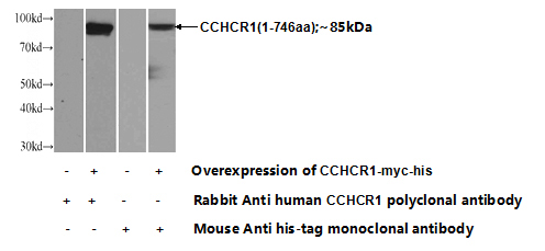 Transfected HEK-293 cells were subjected to SDS PAGE followed by western blot with Catalog No:108995(CCHCR1 Antibody) at dilution of 1:1000