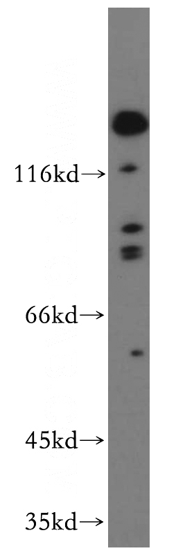 HeLa cells were subjected to SDS PAGE followed by western blot with Catalog No:114776(ROBO4-Specific antibody) at dilution of 1:300