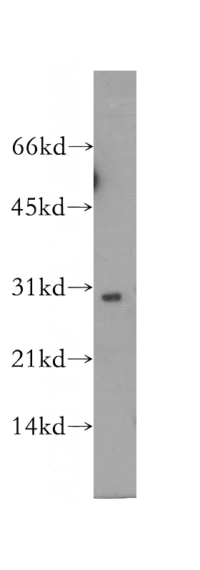 human heart tissue were subjected to SDS PAGE followed by western blot with Catalog No:115012(SCO1 antibody) at dilution of 1:400