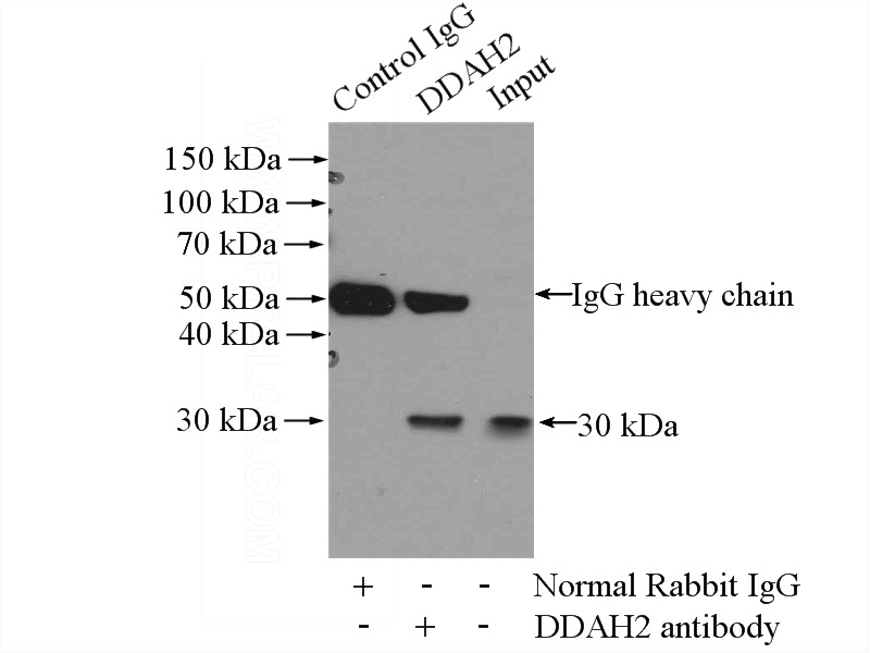 IP Result of anti-DDAH2 (IP:Catalog No:109769, 3ug; Detection:Catalog No:109769 1:500) with COLO 320 cells lysate 2000ug.