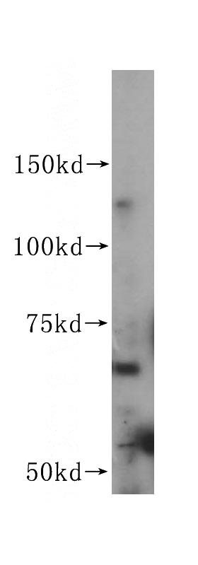 Jurkat cells were subjected to SDS PAGE followed by western blot with Catalog No:107755(ACVRL1 antibody) at dilution of 1:400