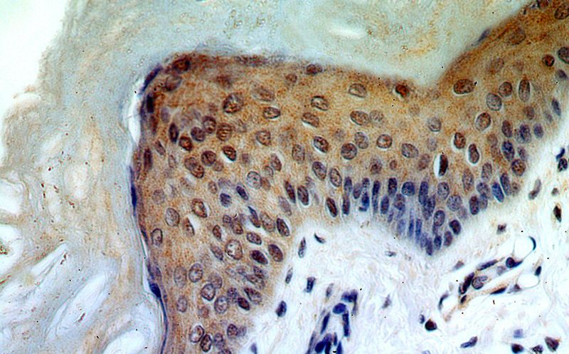 Immunohistochemical of paraffin-embedded human skin using Catalog No:114930(RRP8 antibody) at dilution of 1:100 (under 40x lens)