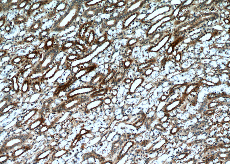 Immunohistochemical of paraffin-embedded human kidney using Catalog No:113358(NUDT19 antibody) at dilution of 1:50 (under 10x lens)