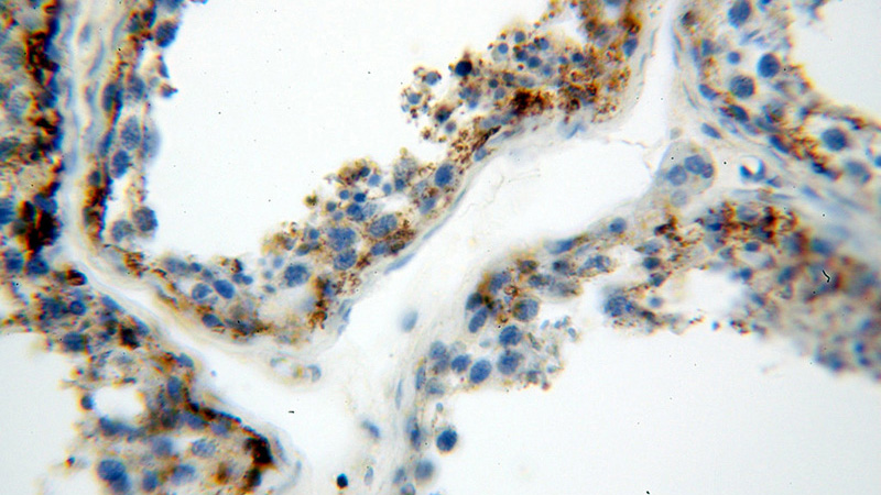 Immunohistochemical of paraffin-embedded human testis using Catalog No:111863(ITGB3 antibody) at dilution of 1:50 (under 40x lens)