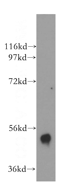 mouse skeletal muscle tissue were subjected to SDS PAGE followed by western blot with Catalog No:108395(B4GALT4 antibody) at dilution of 1:500