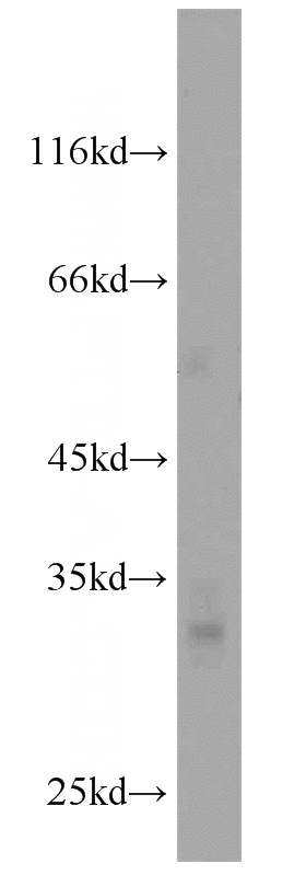 mouse retina tissue were subjected to SDS PAGE followed by western blot with Catalog No:111066(GPM6A antibody) at dilution of 1:600