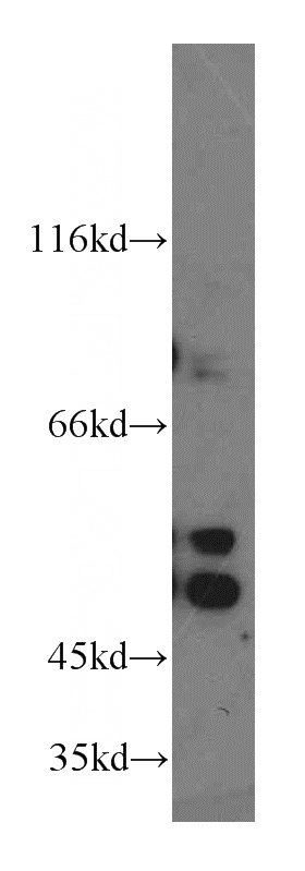 HEK-293 cells were subjected to SDS PAGE followed by western blot with Catalog No:112949(NAPRT1 antibody) at dilution of 1:1000