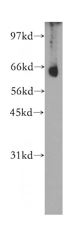 mouse skeletal muscle tissue were subjected to SDS PAGE followed by western blot with Catalog No:109435(CNOT4 antibody) at dilution of 1:300