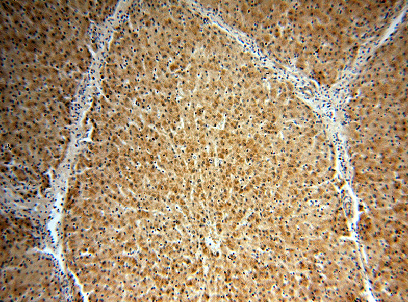Immunohistochemical of paraffin-embedded human liver using Catalog No:109448(COMT antibody) at dilution of 1:100 (under 10x lens)