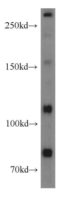 Jurkat cells were subjected to SDS PAGE followed by western blot with Catalog No:112883(MTUS1 antibody) at dilution of 1:500