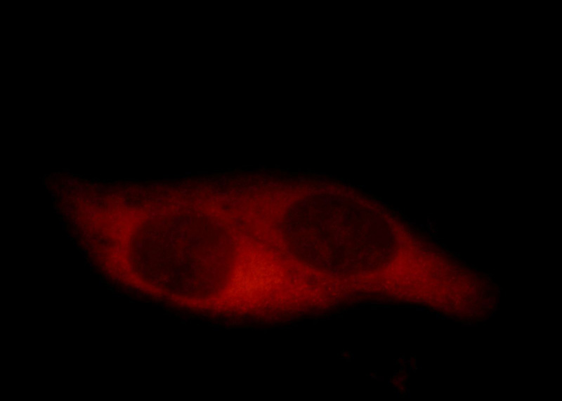 Immunofluorescent analysis of HepG2 cells, using CCT5 antibody Catalog No:109084 at 1:50 dilution and Rhodamine-labeled goat anti-rabbit IgG (red).