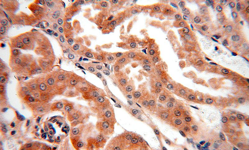 Immunohistochemical of paraffin-embedded human kidney using Catalog No:110771(GABARAPL1 antibody) at dilution of 1:100 (under 40x lens)