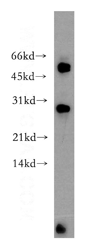 Y79 cells were subjected to SDS PAGE followed by western blot with Catalog No:112313(LRAT antibody) at dilution of 1:500
