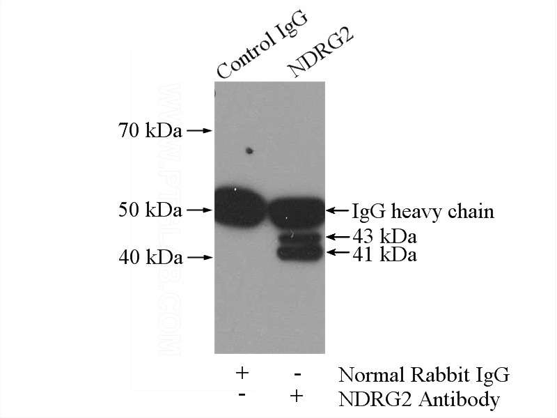IP Result of anti-NDRG2 (IP:Catalog No:113057, 4ug; Detection:Catalog No:113057 1:1000) with rat brain tissue lysate 4000ug.
