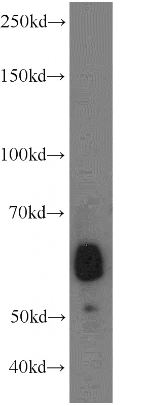 mouse small intestine tissue were subjected to SDS PAGE followed by western blot with Catalog No:108056(ANGPTL2 antibody) at dilution of 1:300