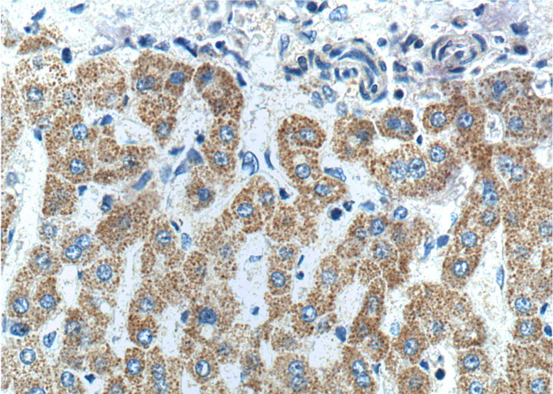 Immunohistochemistry of paraffin-embedded human liver tissue slide using Catalog No:110737(FNDC3B Antibody) at dilution of 1:200 (under 40x lens).