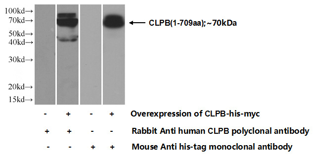 Transfected HEK-293 cells were subjected to SDS PAGE followed by western blot with Catalog No:109400(CLPB Antibody) at dilution of 1:700