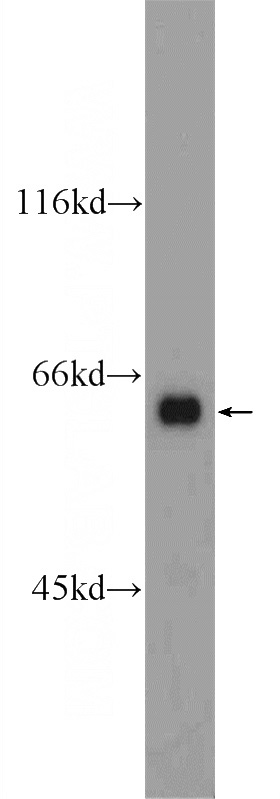 mouse brain tissue were subjected to SDS PAGE followed by western blot with Catalog No:108360(Barkor Antibody) at dilution of 1:600