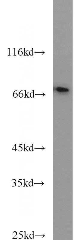 mouse brain tissue were subjected to SDS PAGE followed by western blot with Catalog No:109013(CD24 antibody) at dilution of 1:1000