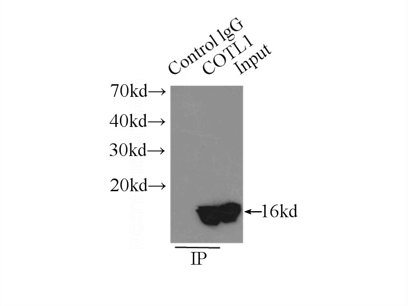 IP Result of anti-COTL1 (IP:Catalog No:109480, 3ug; Detection:Catalog No:109480 1:3000) with mouse kidney tissue lysate 12500ug.