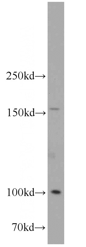 mouse spleen tissue were subjected to SDS PAGE followed by western blot with Catalog No:111855(ITGA6-Specific antibody) at dilution of 1:300